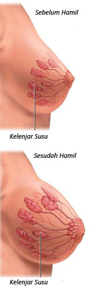 Perubahan bentuk payudara ibu hamil