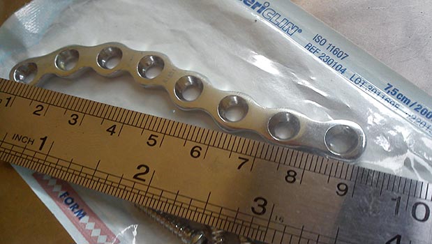 Panjang pen clavicula kanan saya 9 cm