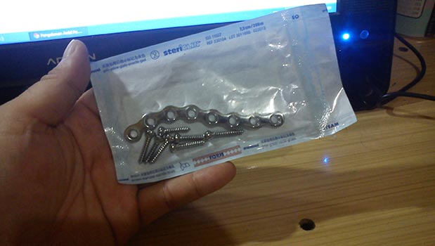 Pen Tulang Selangka Kanan Saya