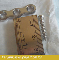 Panjang sekrup pen clavicula kanan